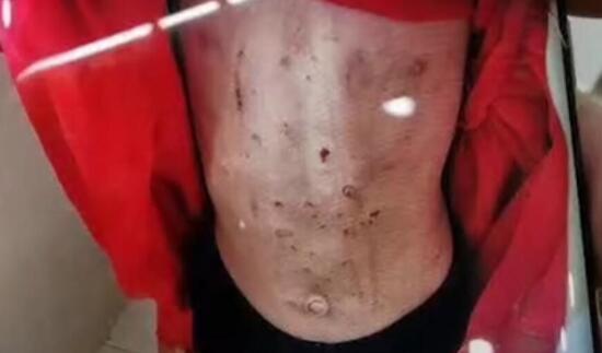 警方通報黑龍江女童被虐打事件