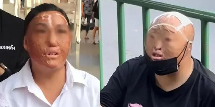曼谷出現(xiàn)多名中國籍毀容乞討者